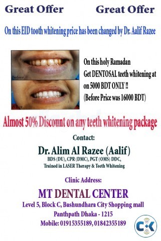 Teeth whitening Dentosal at low price with scaling large image 0