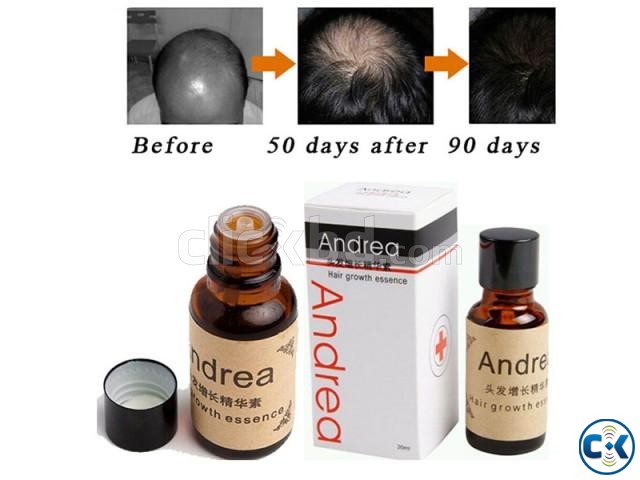 2016 New Arrival Andrea Hair Growth Essence. large image 0