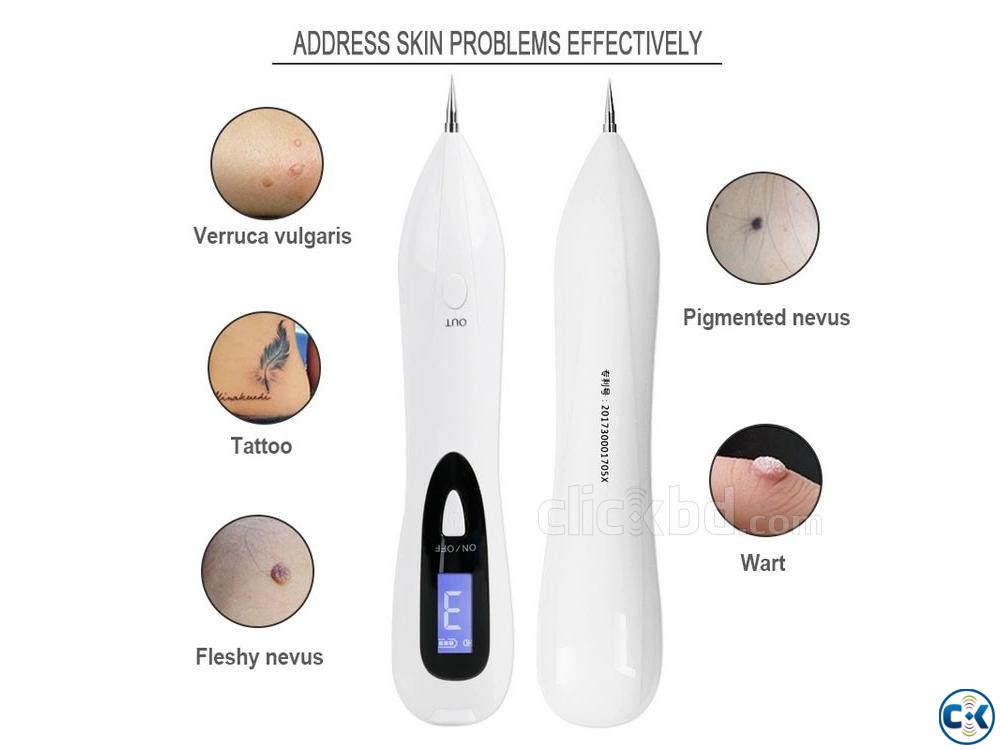 Plasma Pen with LCD Screen Tattoo Remove Mole Remover pen large image 0