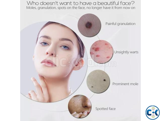 Electro Cautery Mole Skin Tags Warts Removal machine | ClickBD image 2