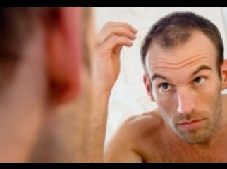 Stop Your Hair Fall or Loss Now