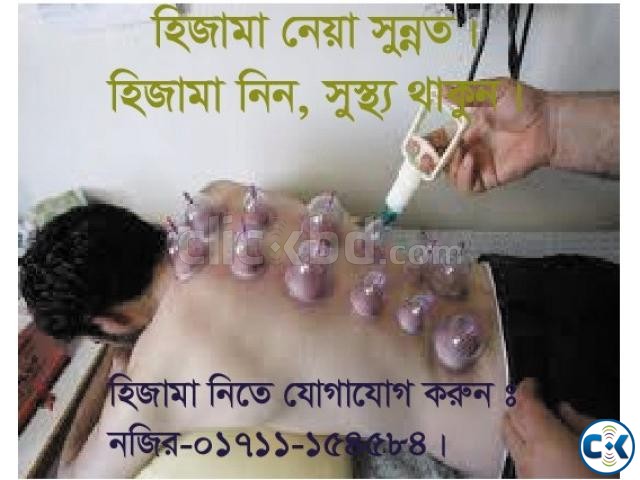 Hijama For Black Magic  large image 0