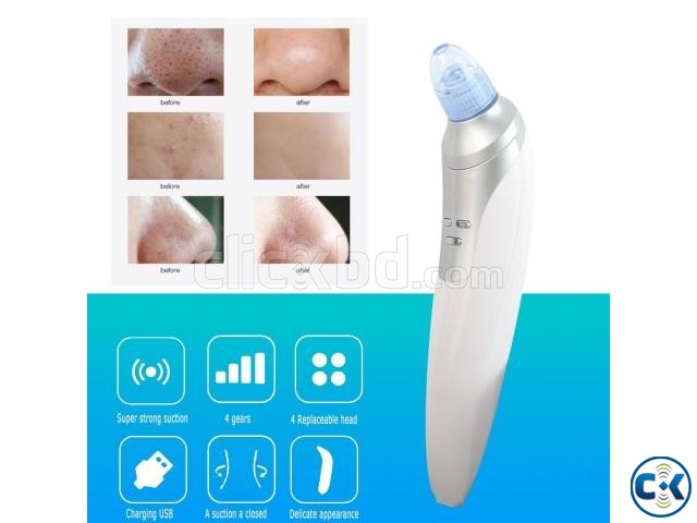 Blackhead Comedo Pimple Remover Acne Extraction Facial Pore large image 0