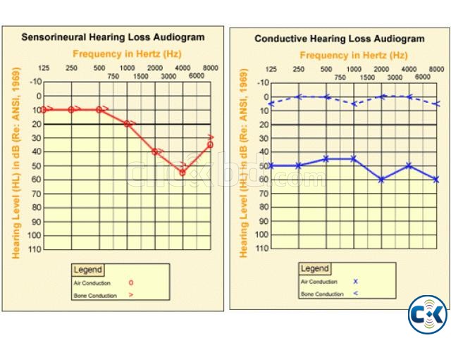 Dhanmondi Rehab Hearing Center give a huge offer on the test large image 0