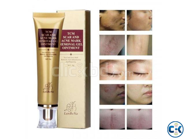 TCM SCAR AND ACNE MARK REMOVAL GEL OINTMENT 30g large image 3